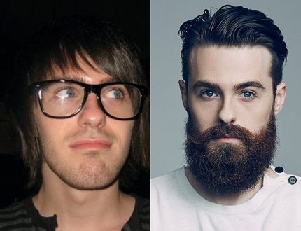 Barba! Antes e depois!  Imagem: Reprodução 