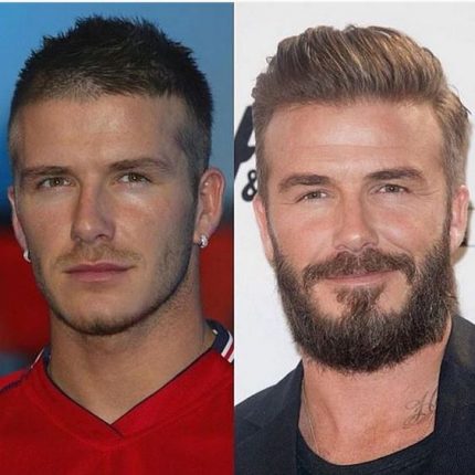 Barba! Antes e depois!  Imagem: Reprodução 