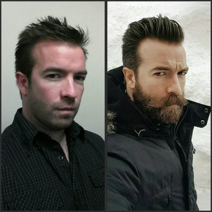 Barba! Antes e depois!  Imagem: Reprodução 