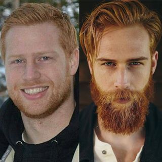 Barba! Antes e depois!  Imagem: Reprodução 